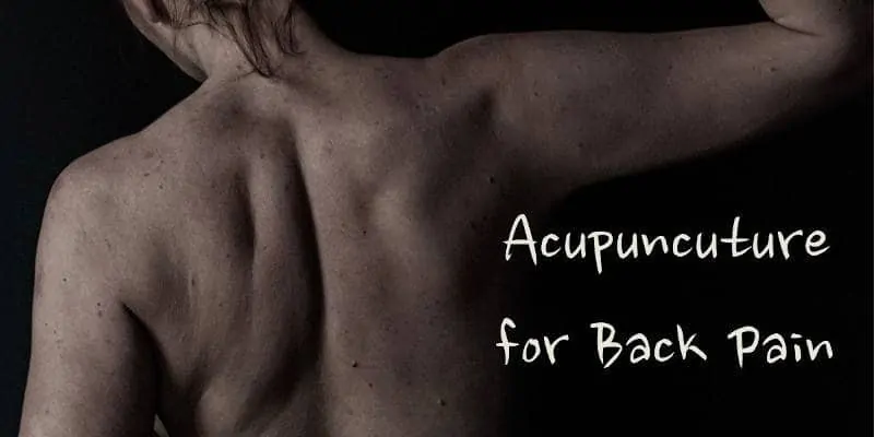 Acupuncuture for Back Pain